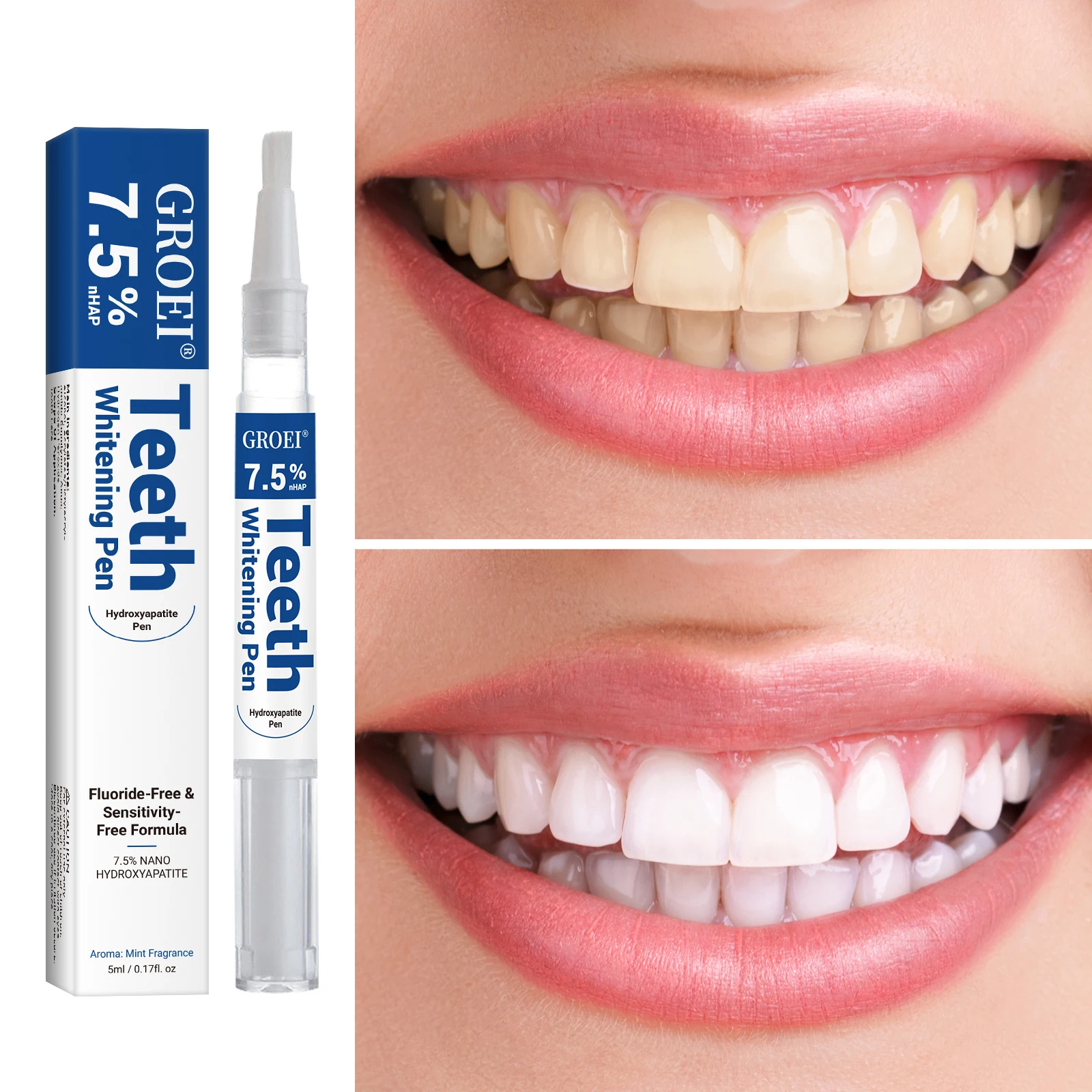 Hydroxyapatite Tooth Whitening - огляд і ціна Teeth Whitening Gels