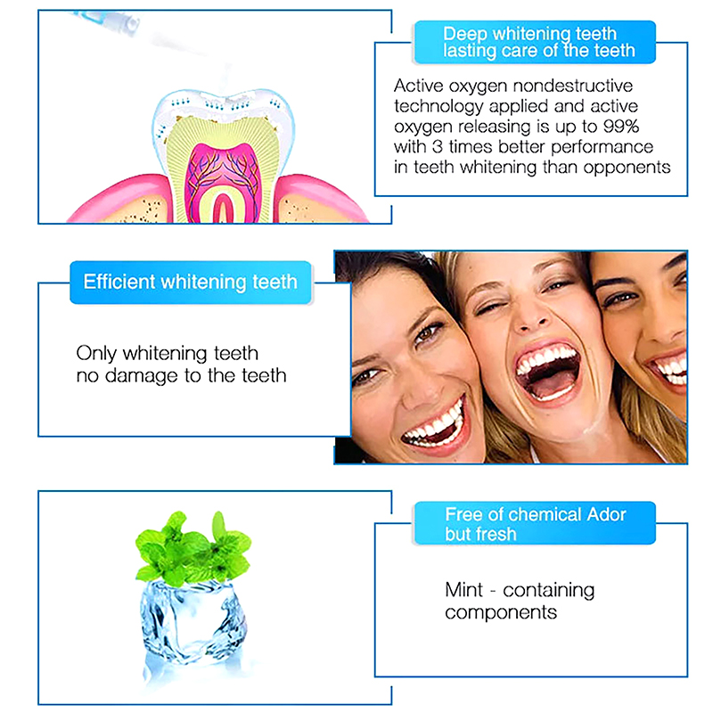 Teeth Whitening Pen Profession - огляд і ціна Teeth Whitening Gel Pen