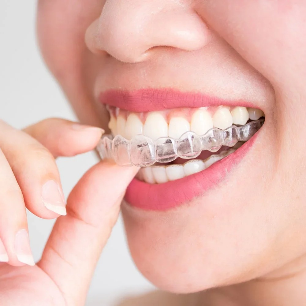 1-4Pc Anti Snoring Bruxism Sle - огляд і ціна Teeth Whitening Mouth Guard