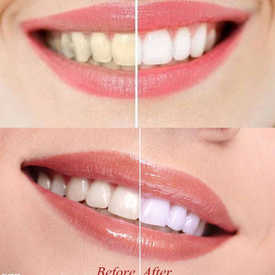 Bamboo Charcoal Teeth Tooth De - огляд і ціна Teeth Whitening China