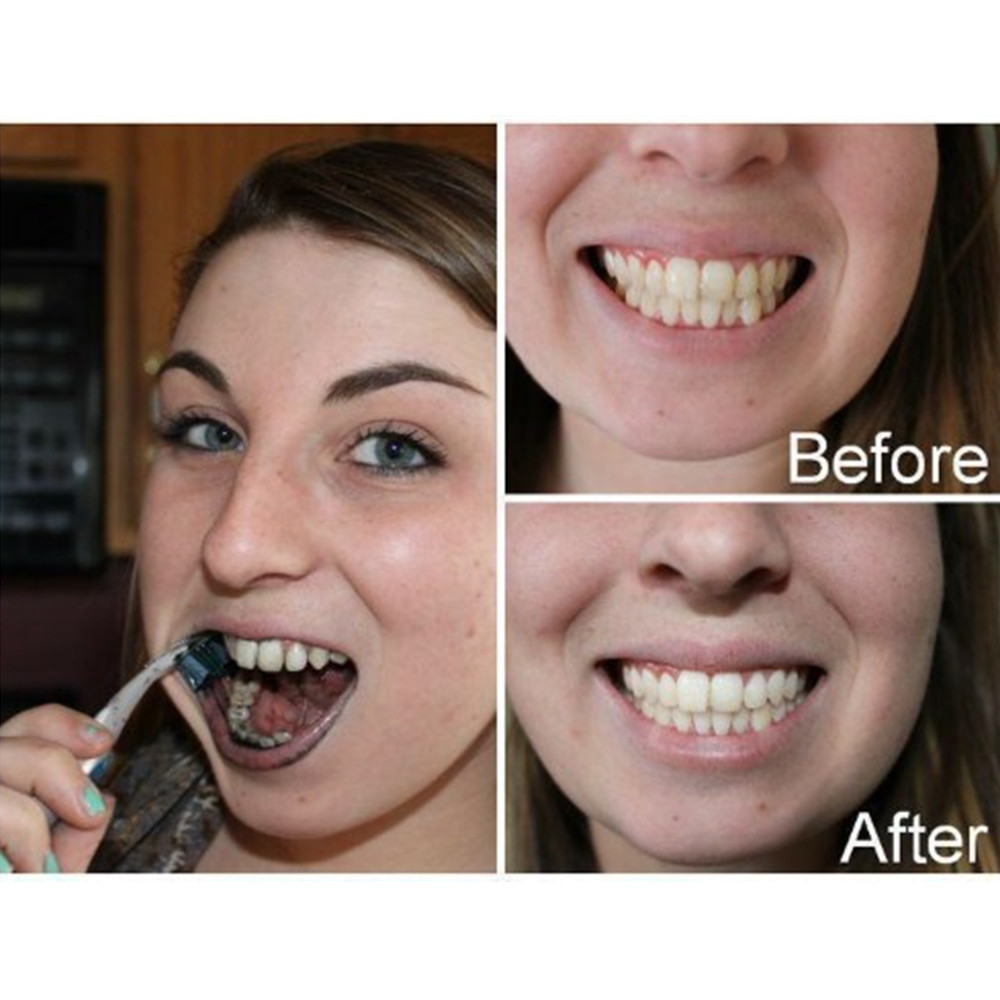 Bamboo Charcoal Teeth Tooth De - огляд і ціна Teeth Whitening China