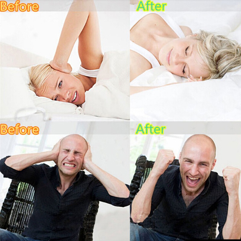 Silicone Anti-Teeth Grinding M - огляд і ціна Teeth Whitening Mouth Guard