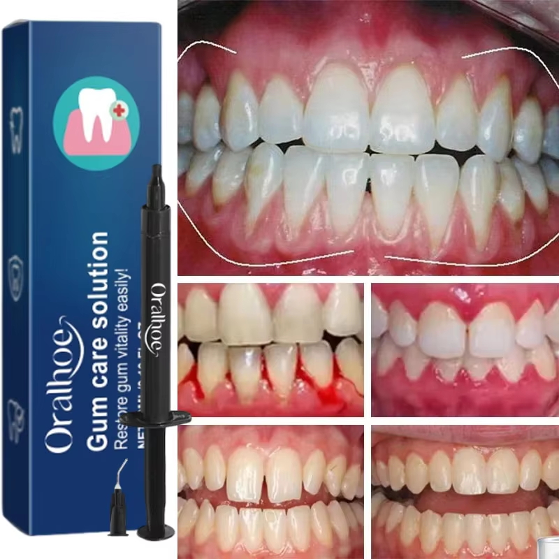 Teeth Whitening Gel Gum Repair - огляд і ціна Teeth Whitening Gels