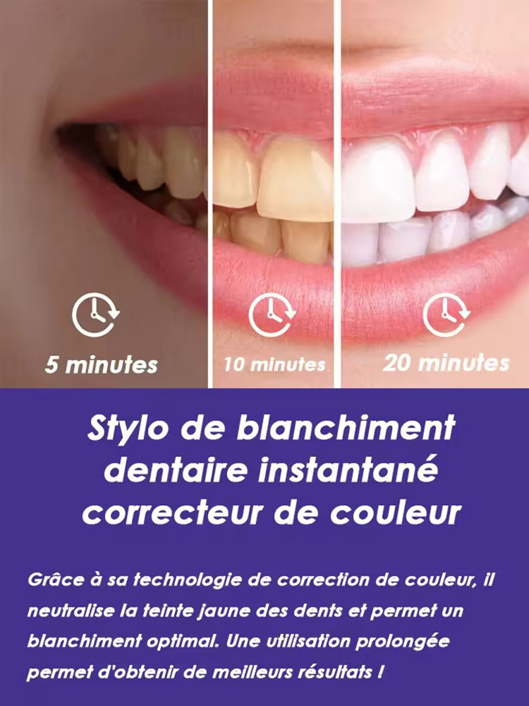 8ml*2 Teeth Whitening Pen Set  - огляд і ціна Teeth Whitening Gel Pen