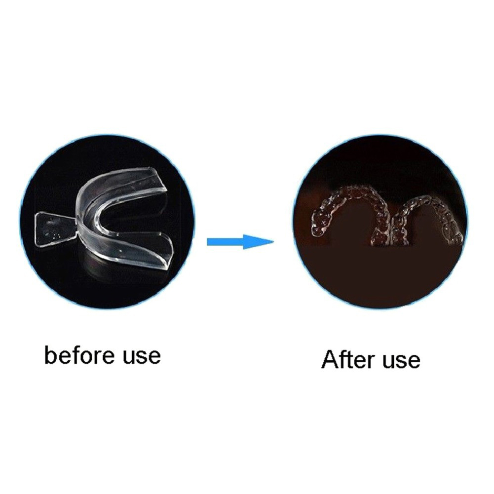 2/4pcs Soft Tooth Orthodontic  - огляд і ціна Teeth Whitening Mouth Guard