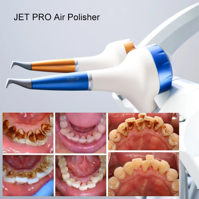 VV Dental  Air Polishing Proph - огляд і ціна Teeth Whitening China