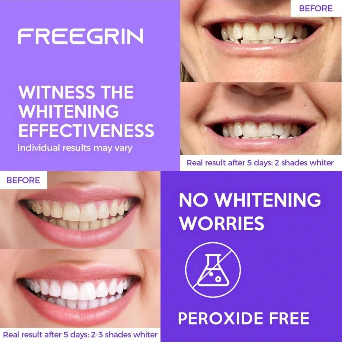 Deluxe Whitening Teeth Sticker - огляд і ціна Teeth Whitening Ai
