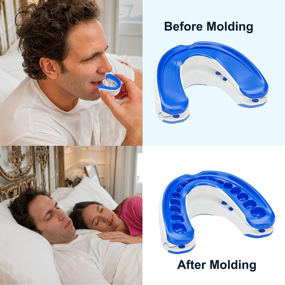 Anti-Snoring Mouthpiece Anti-S - огляд і ціна Teeth Whitening Mouth Guard