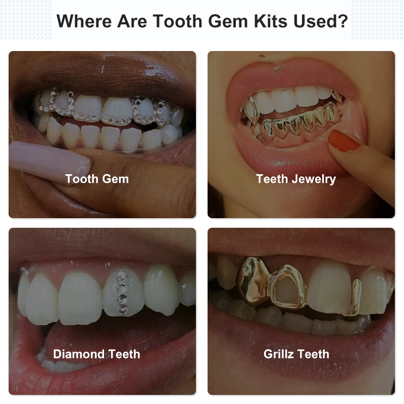 Tooth Gem Set Glue Kit with UV - огляд і ціна Uv Whitening Kit