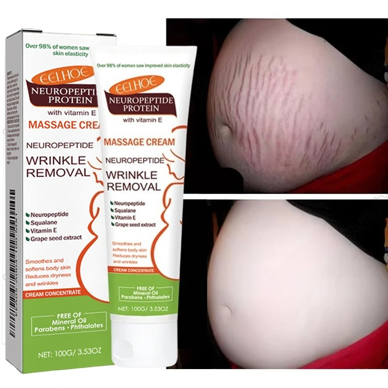 100g Stretch Marks Permanent R - огляд і ціна Teeth Whitening Pregnancy